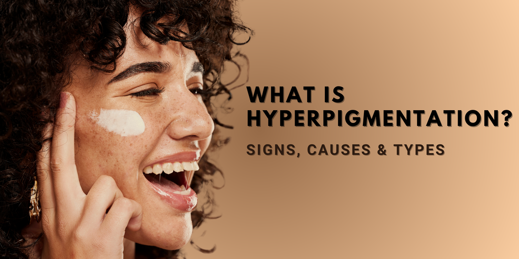What Is Hyperpigmentation? Its Signs, Causes & Types