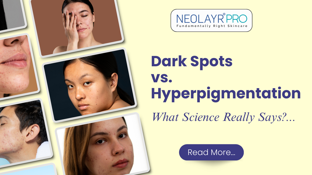 Dark Spots vs. Hyperpigmentation: What Science Really Says?