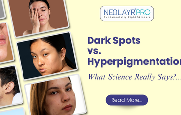 Dark Spots vs. Hyperpigmentation: What Science Really Says?