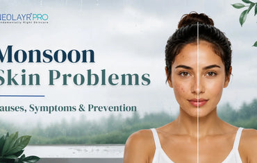 5 Common Monsoon Skin Problems and How to Prevent Them