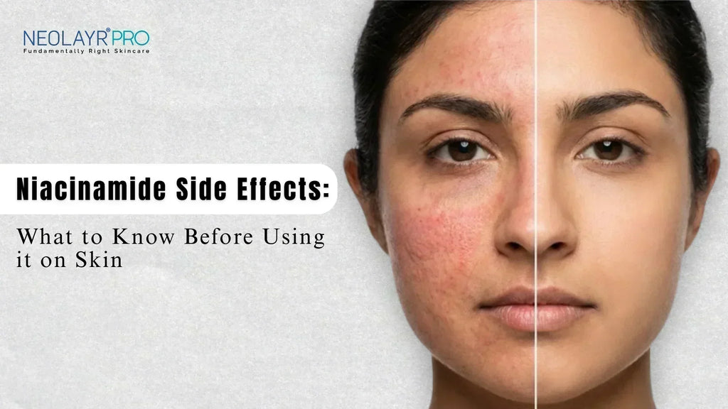 Niacinamide Side Effects: What to Know Before Using It on Skin