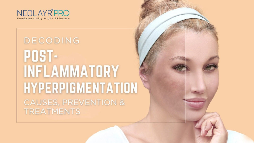 Post-Inflammatory Hyperpigmentation: Causes, Prevention & Treatments
