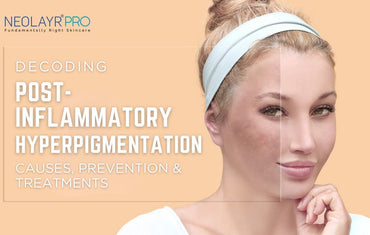 Post-Inflammatory Hyperpigmentation: Causes, Prevention & Treatments