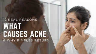 12 Real Reasons What Causes Acne & Why Pimples Return