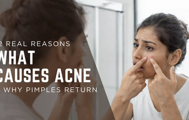 12 Real Reasons What Causes Acne & Why Pimples Return