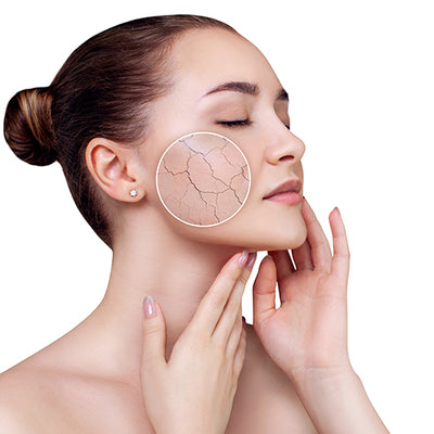 Dry / Dehydrated Skin
