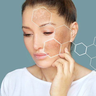 Pigmentation & Dark Spots