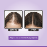 Neolayr Pro Prohair Quick Hair Fall Control Solution 40 ml
